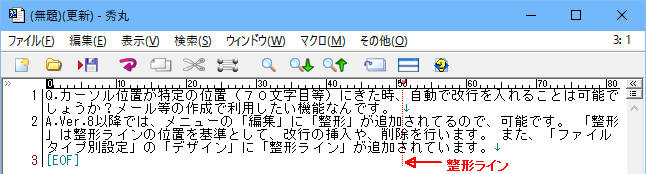 整形ライン表示